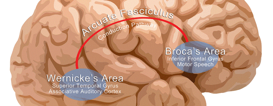 Aphasia