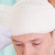 Traumatic Brain Injury (TBI)